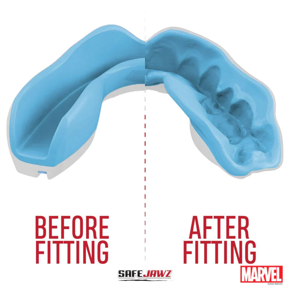 Safejawz Marvel Spider-Gwen Mouthguard - Image 6
